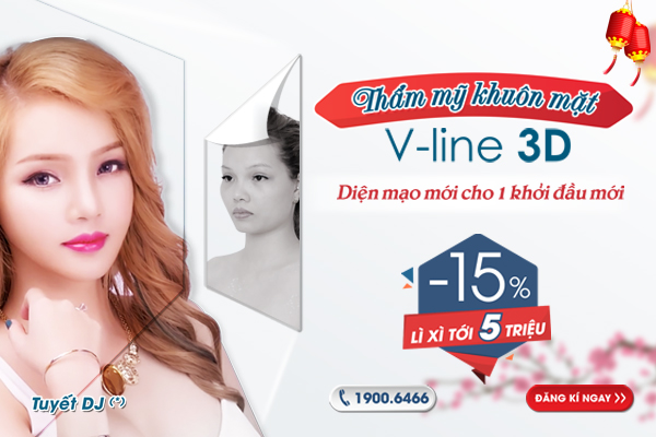 [OFF 15%] Thẩm mỹ khuôn mặt V-line 3D: Diện mạo mới cho 1 khởi đầu mới