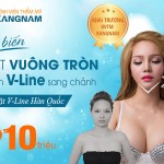 Hô biến mặt Vuông, Tròn thành Vline sang chảnh: Tặng ngay 10 triệu nhân dịp khai trương bệnh viện TM Kangnam 28/11