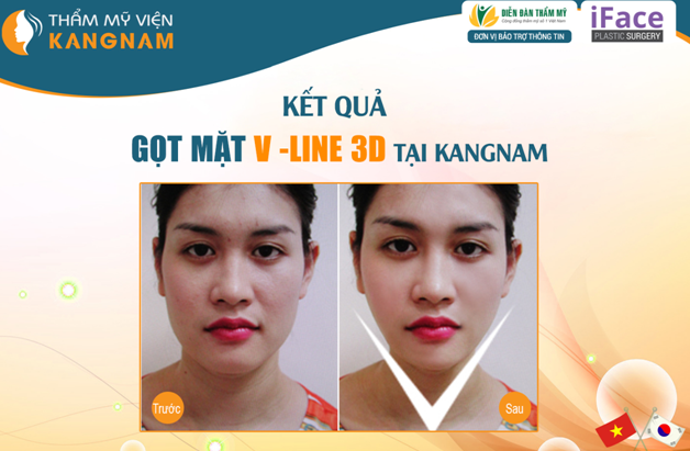 got-mat cong nghe 3d