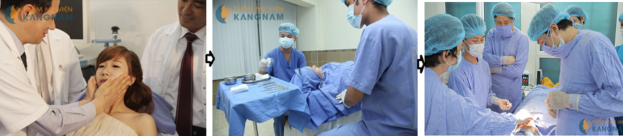 Bật mí phương pháp phẫu thuật chỉnh hình cằm toàn diện 8