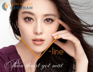 Gọt mặt V-line an toàn, hiệu quả tại thẩm mỹ viện Kangnam