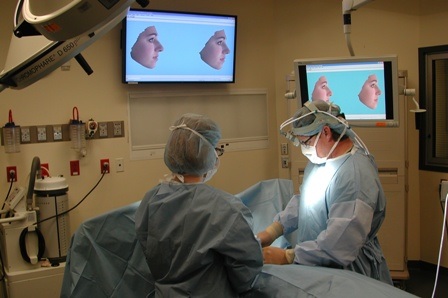 Phẫu thuật gọt mặt nội soi - Thẩm mỹ khuôn mặt toàn diện 3